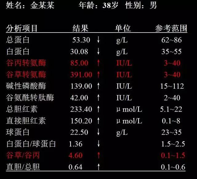 谷丙,谷草转氨酶升高是不是肝出问题了